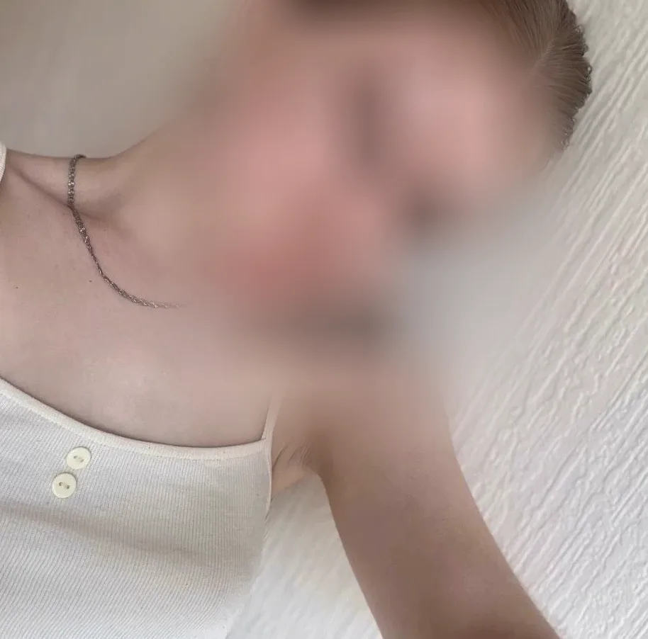 Yara, 24